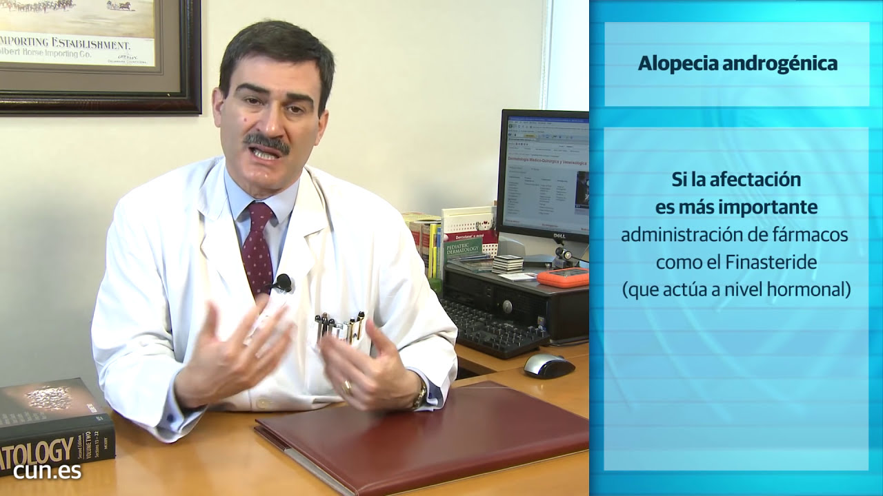 Alopecia. Pérdida de pelo. Causas, tipos, tratamiento.