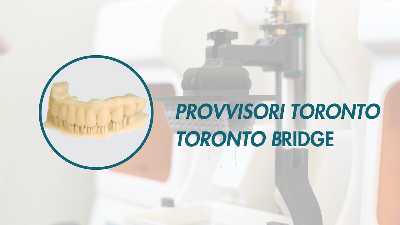 Galaxy 6 Plus con Resina COMPACT Temporary - Provvisori toronto/Toronto bridge