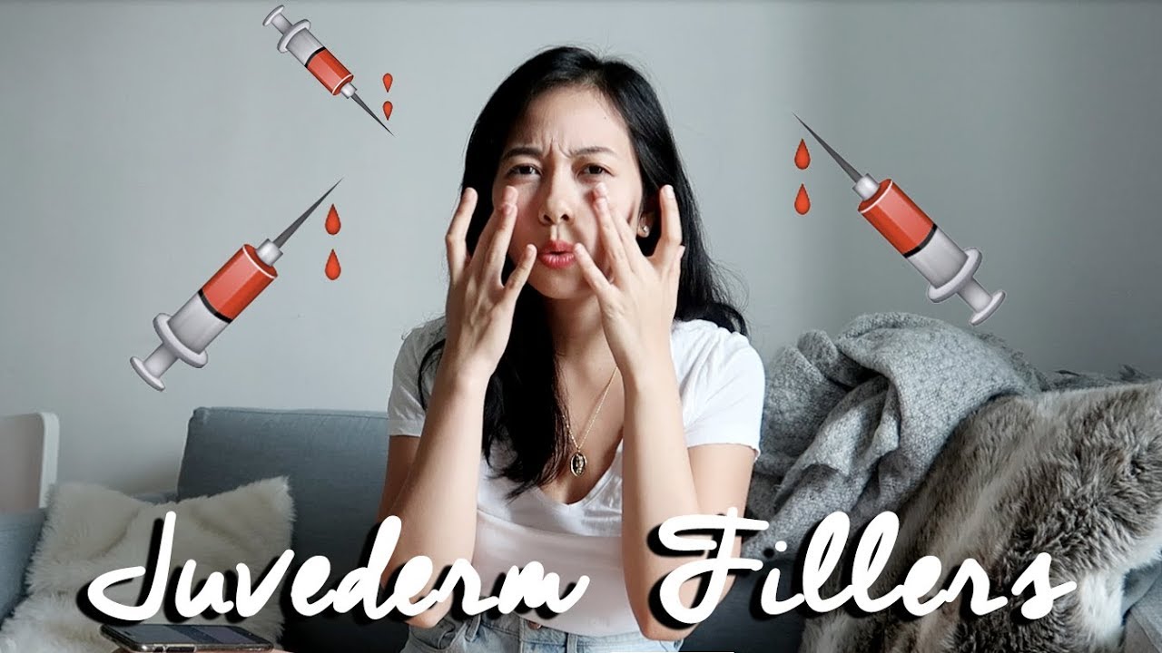 My Tear Trough Filler Experience | Juvederm Ultra XC | Malaysia