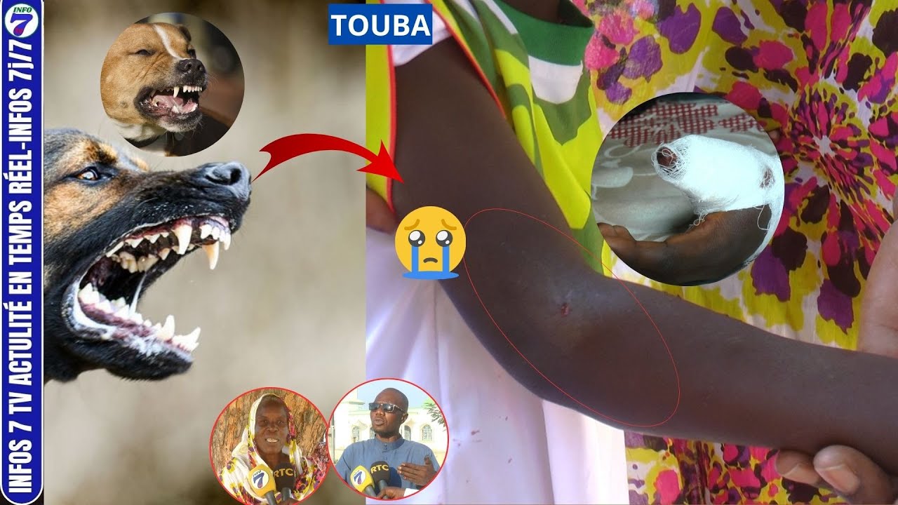 Touba: 05 enfants mordus par un chien au quartier Keur Niang.. Regardez ce qui s'est passé...
