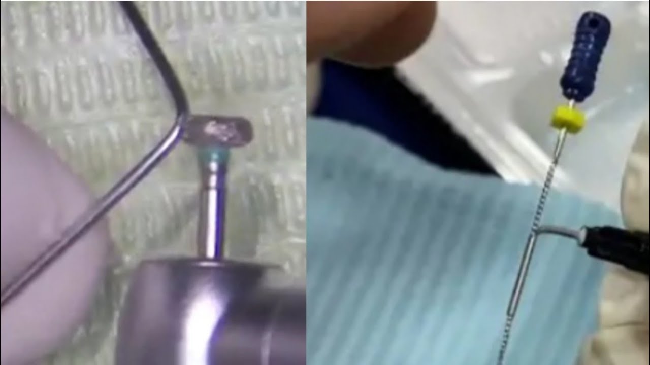 Custom Extractor For separated file ( broken file retrieval ) Dr/mina moheb