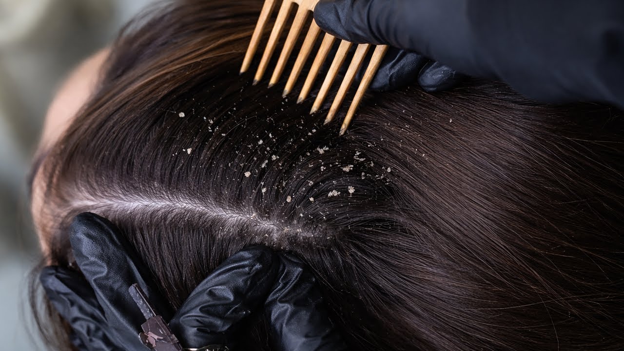 Professional Scalp Care ASMR | Gentle Hair Cleaning Session for Deep Sleep