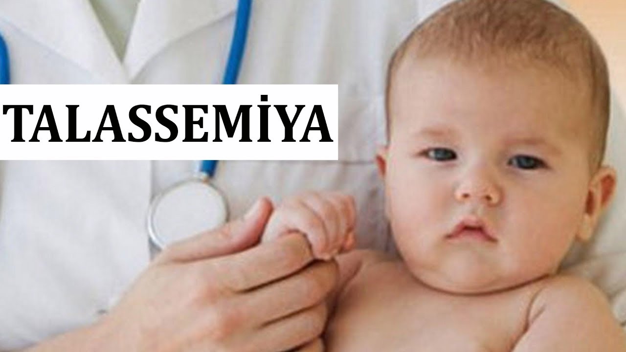 Uşaqlarda Talassemiya xəstəliyinin SƏBƏBLƏRİ