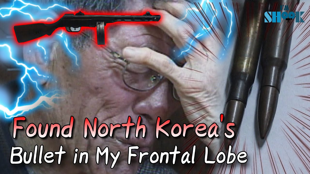 A Giant Bullet in My Frontal Lobe🧠😱 But...How..?