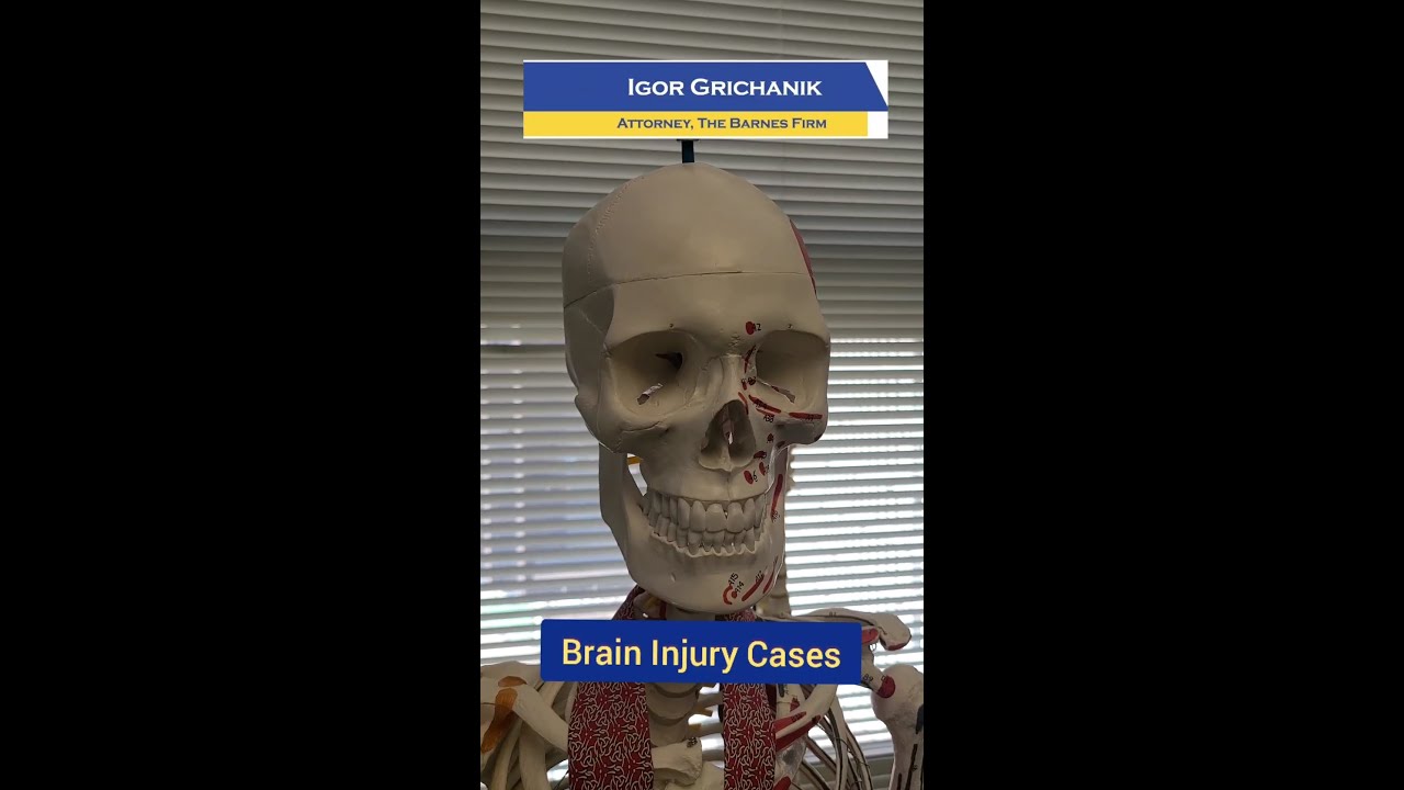 Whiplash can lead to Traumatic Brain Injury - TBI discussed by Senior Trial Attorney Igor Grichanik