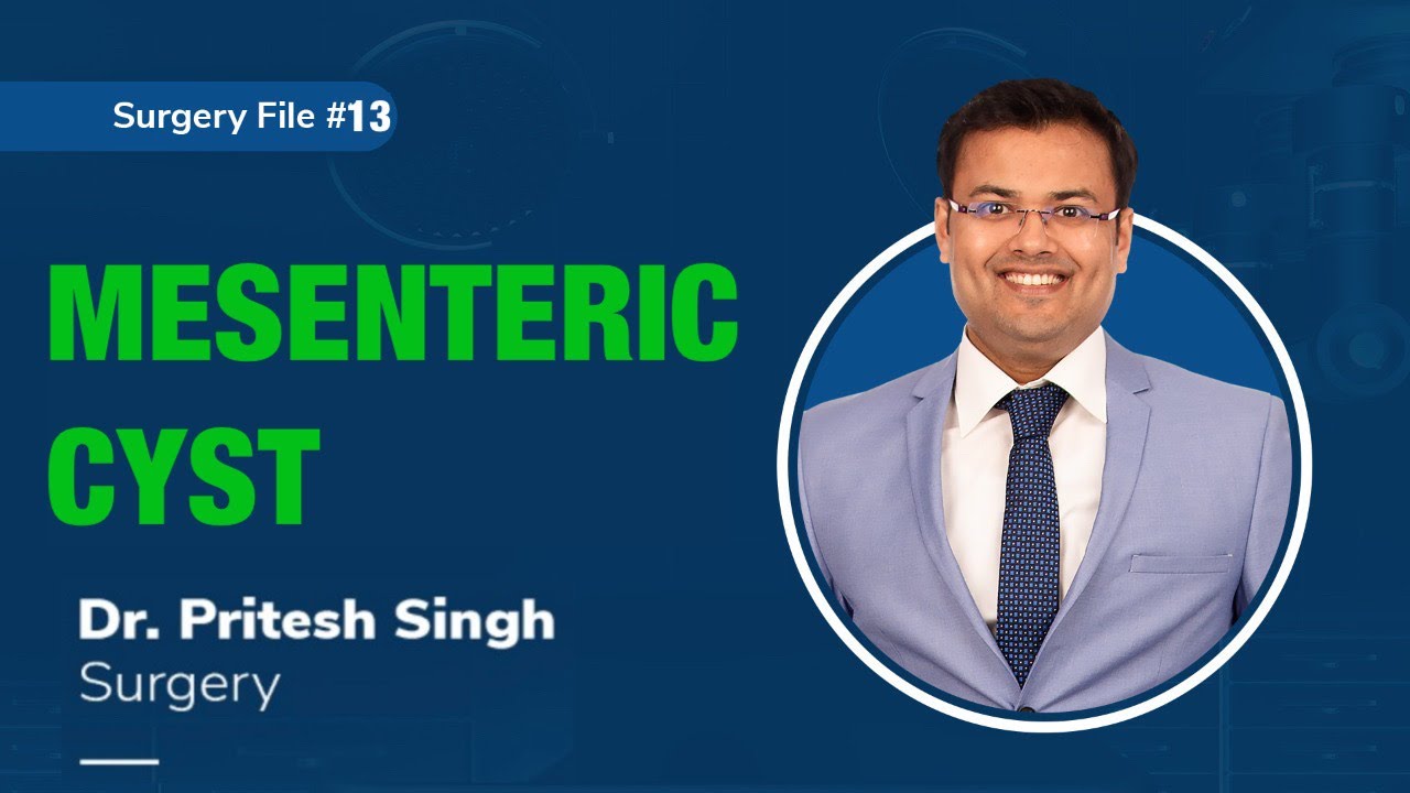 Topic | MESENTERIC CYST I Dr. Pritesh SIngh | Surgery