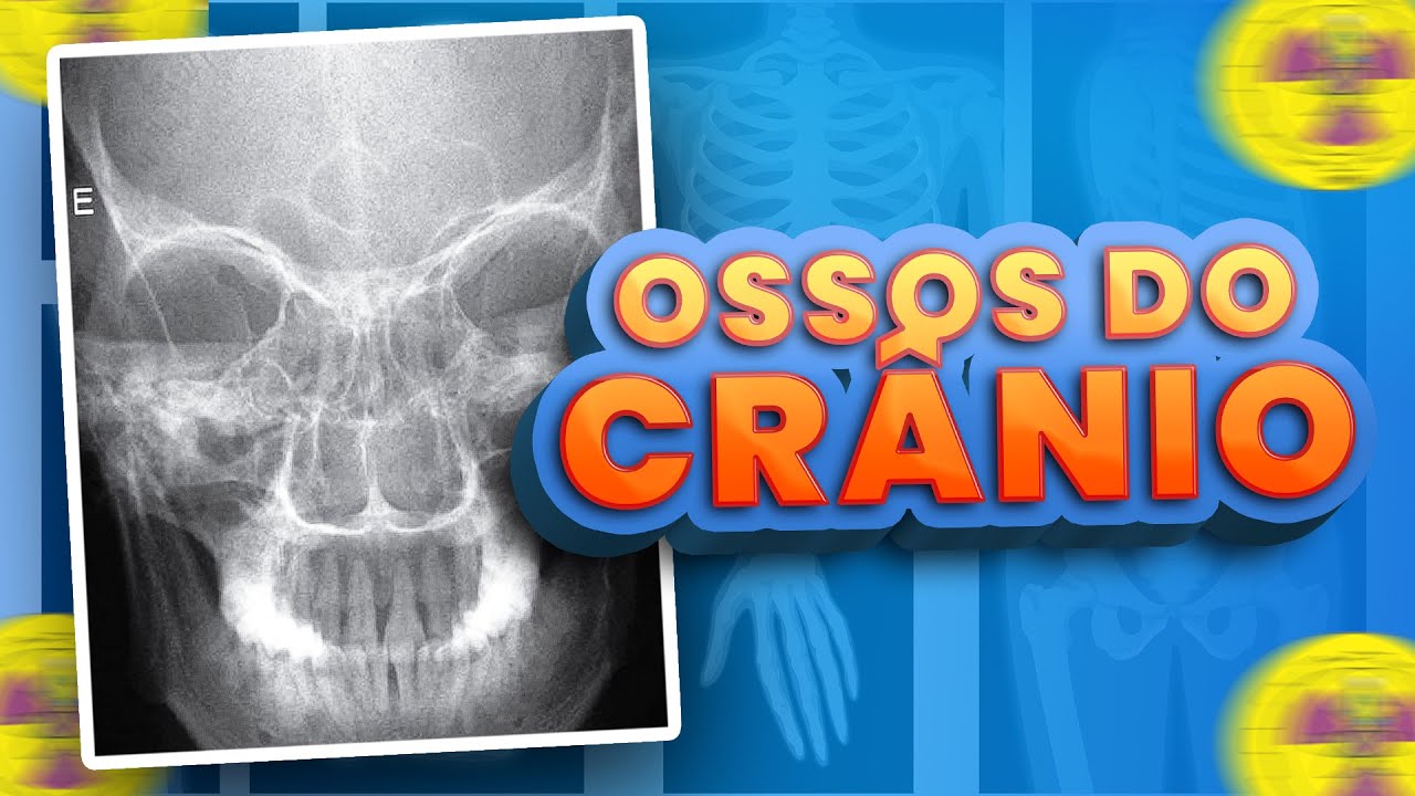 TODOS OS OSSOS DO CR&Acirc;NIO | Radiologando