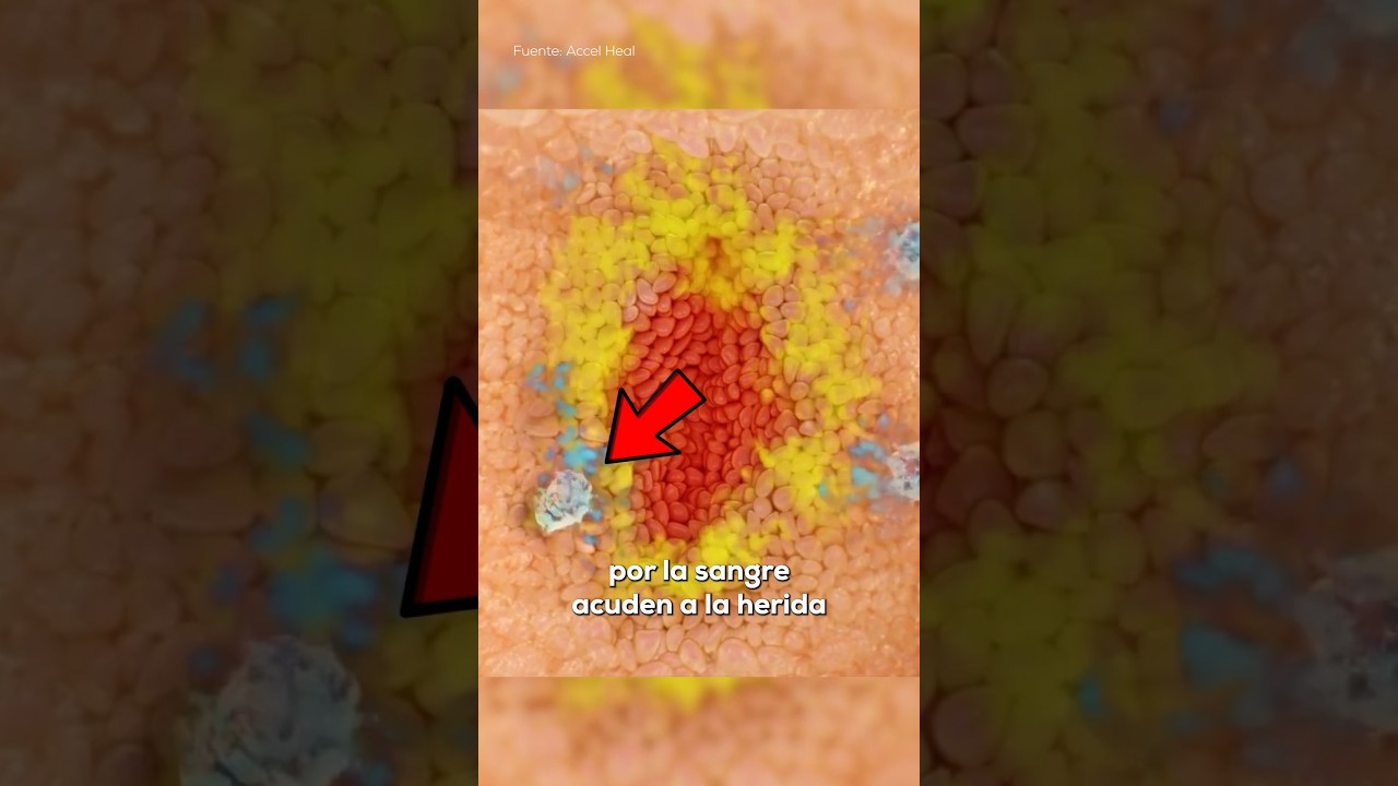 As&iacute; se CURA una HERIDA🤔 🩹🩸