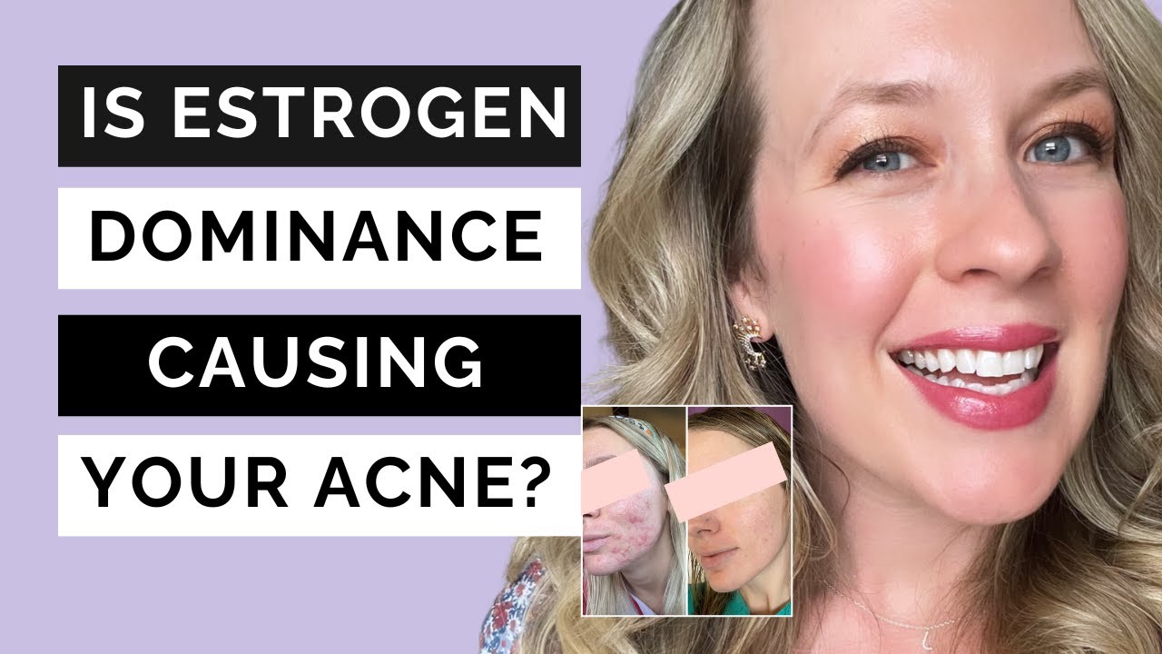 Estrogen dominance acne - IS ESTROGEN CAUSING YOUR ACNE?