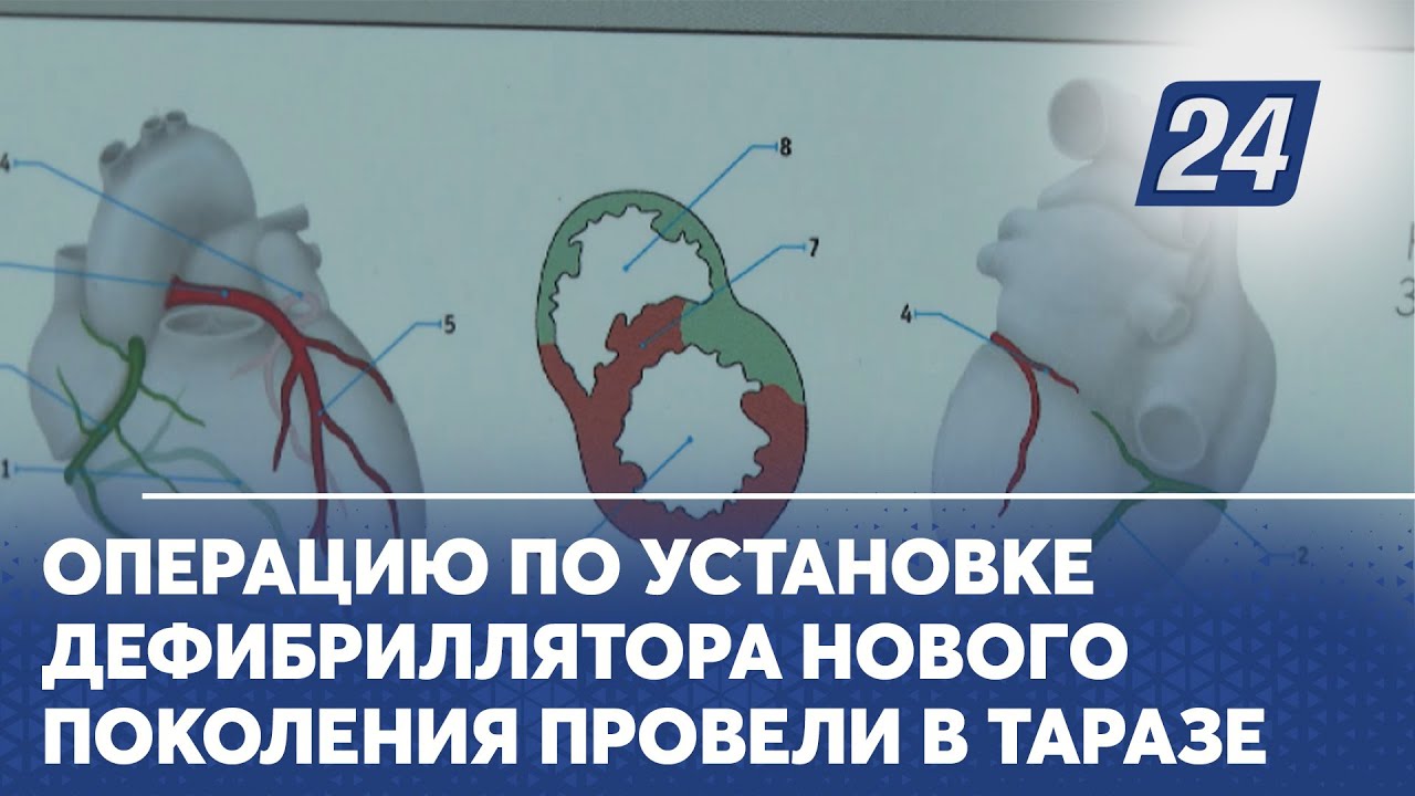 Операцию по установке дефибриллятора нового поколения провели в Таразе