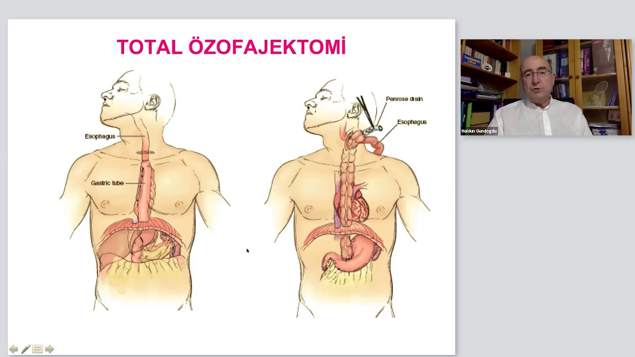30.12.2020 - Nütrisyon Network - Gastrointestinal Cerrahiler
