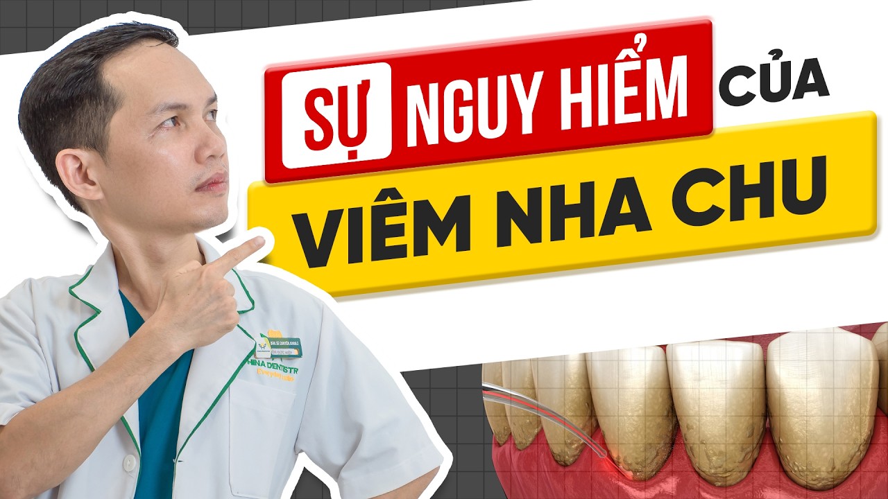 Viêm Nha Chu - Kẻ Thù Âm Thầm Khiến Bạn Mất Răng | Nha Khoa Hina