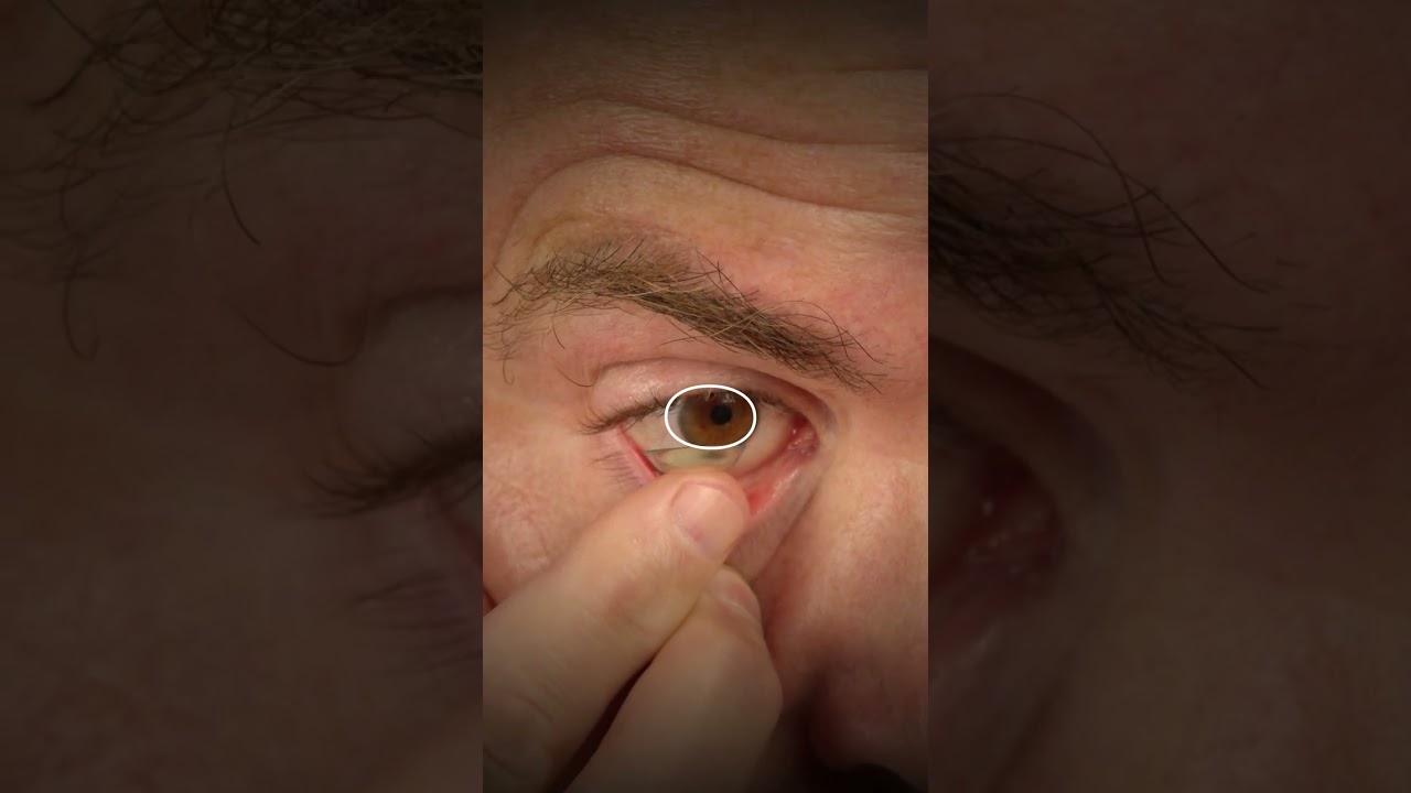 How to Insert a Contact Lens #DeliverContacts.com #YourEyeShow