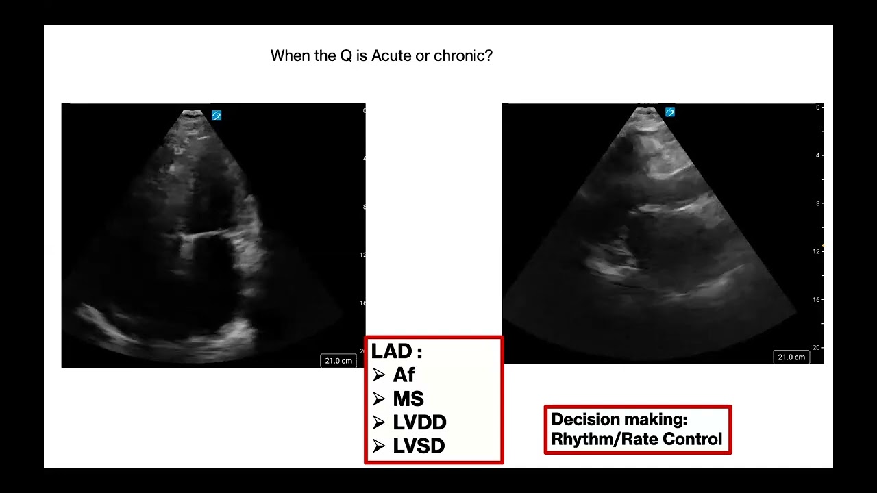 Role of echo in acute and critical settings By Dr/ Ashraf Al TayarConsultant Acute Medicine -NHS-UK