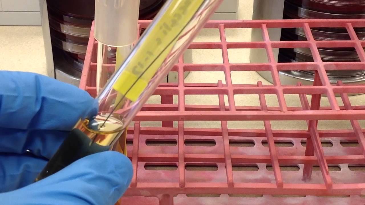 Микробиология – желчный эскулин и 6,5% NaCl