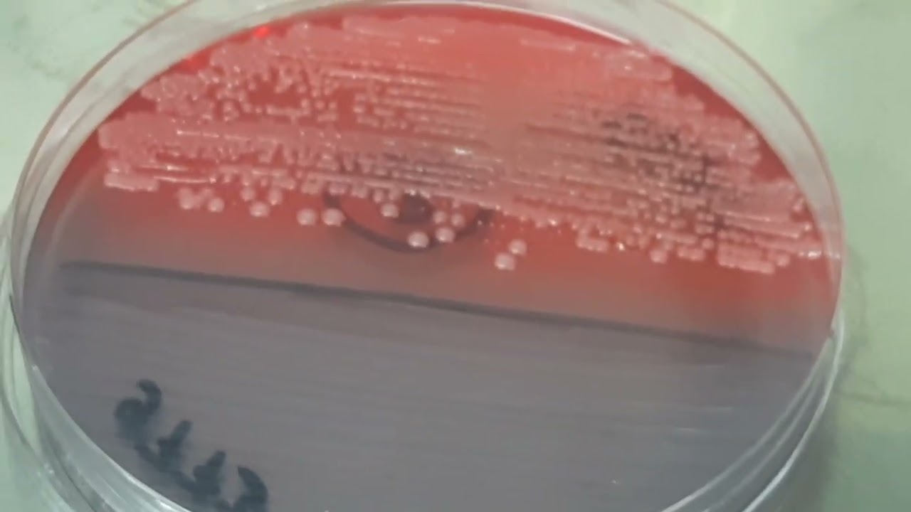 Klebsiella oxytoca on CLED Agar