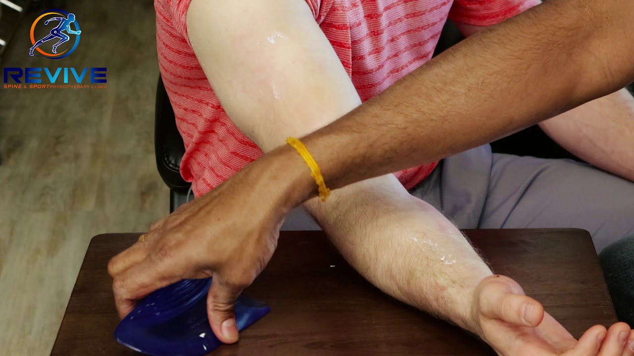 How to get your tennis elbow treated properly, a video by a physiotherapist and chiropractor