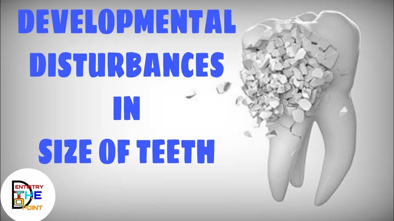 DEVELOPMENTAL DISTURBANCES IN SIZE OF TEETH