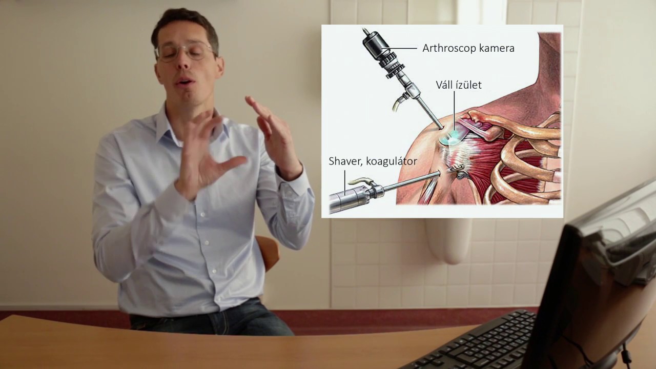 Váll fájdalmas becsípődése - Vállcentrum // Dr. Gulyás Károly