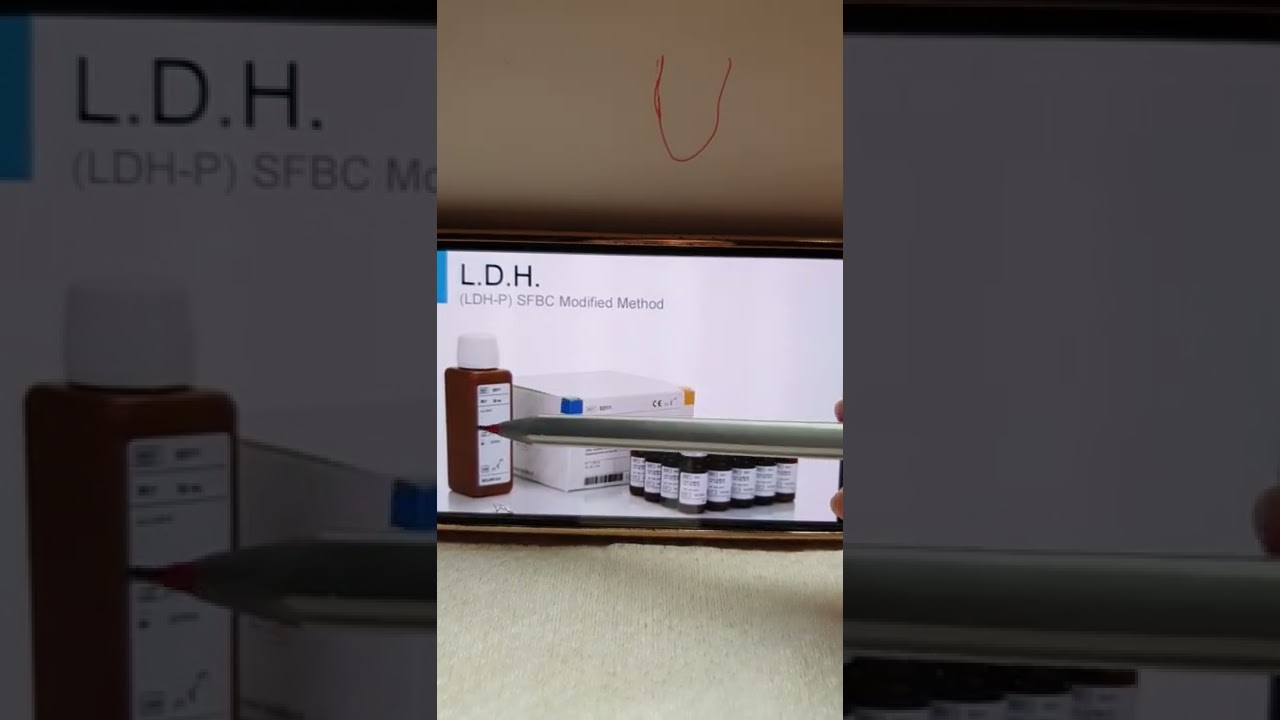تحليل ال (LDH)  الشرح الكامل عنه وعن كيفية اجرائه