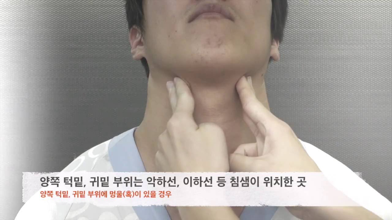 목에 멍울이 있는 경우 - 위드심의원