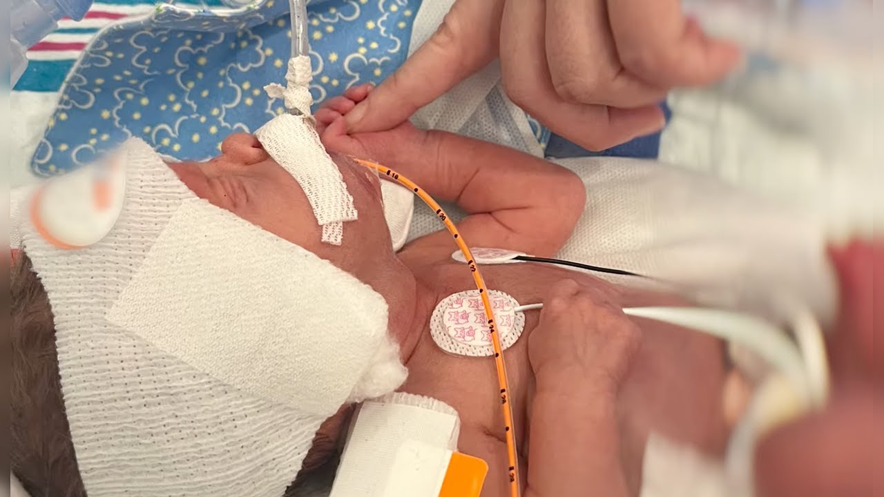 Hadley's Fight | Why Families Travel Across the Country for Nationwide Children’s BPD Care