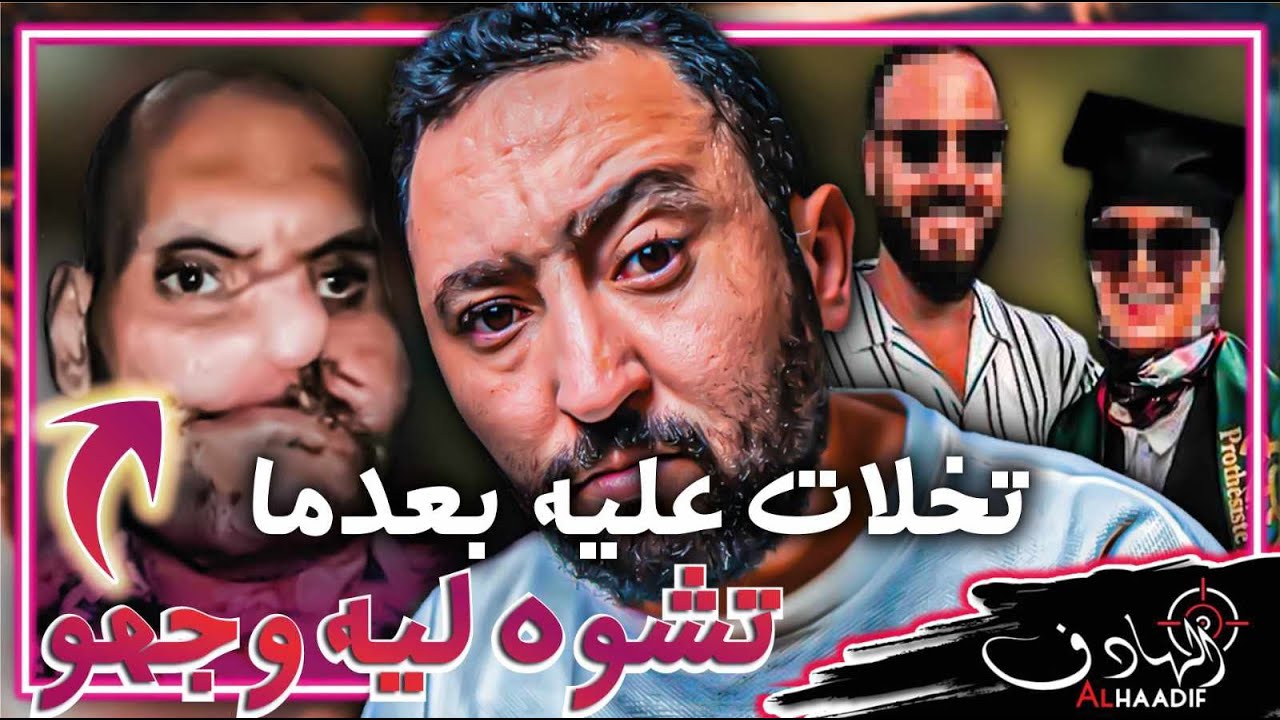 خلاتو صاحبتو حيت وجهو تشــ،ــوه بسبها !؟