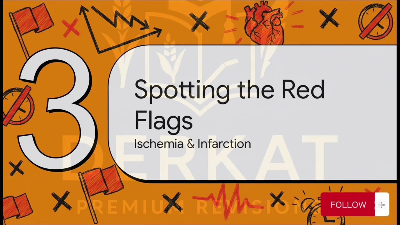 ECG