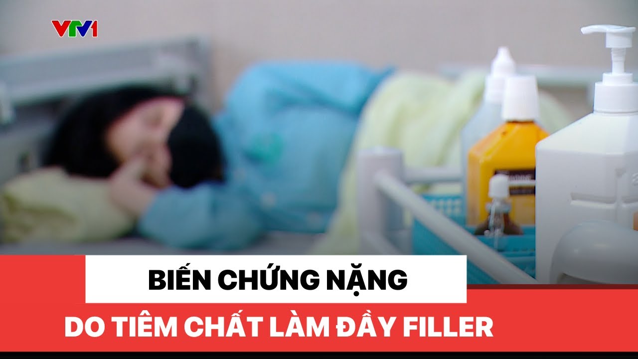 Biến chứng nặng do tiêm chất làm đầy filler