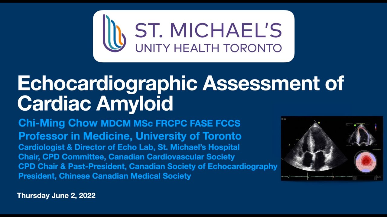 Echocardiographic Assessment of Cardiac Amyloidosis