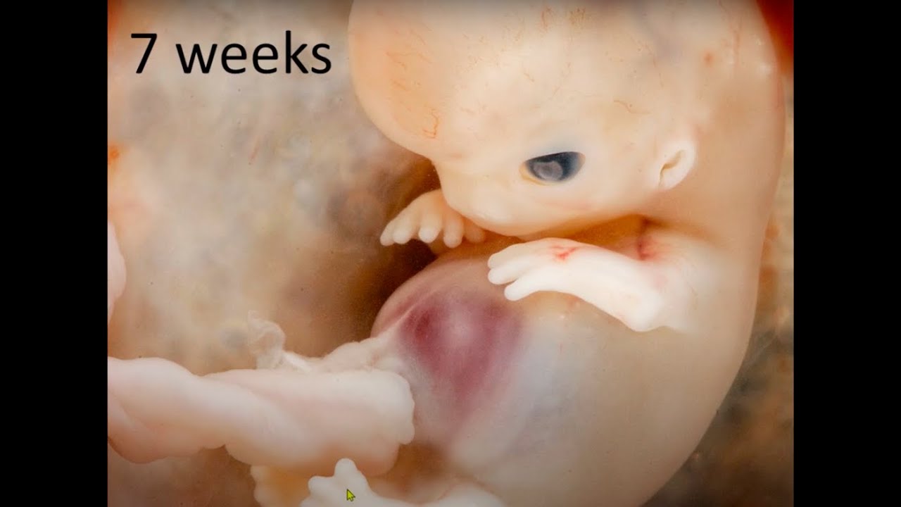 Fetal development