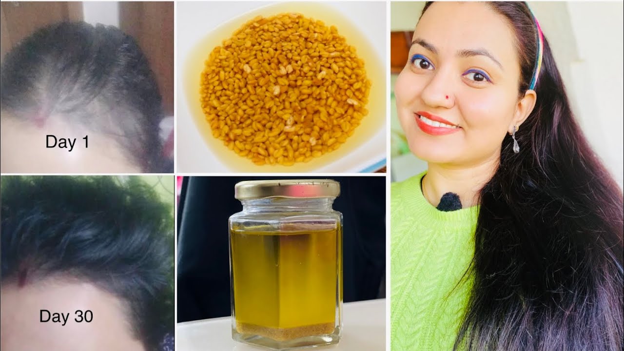 Winter Hair Growth Transformation Challenge To Regrow Lost Hair|खोये हुए बाल वापस उगाने का अचूक उपाय