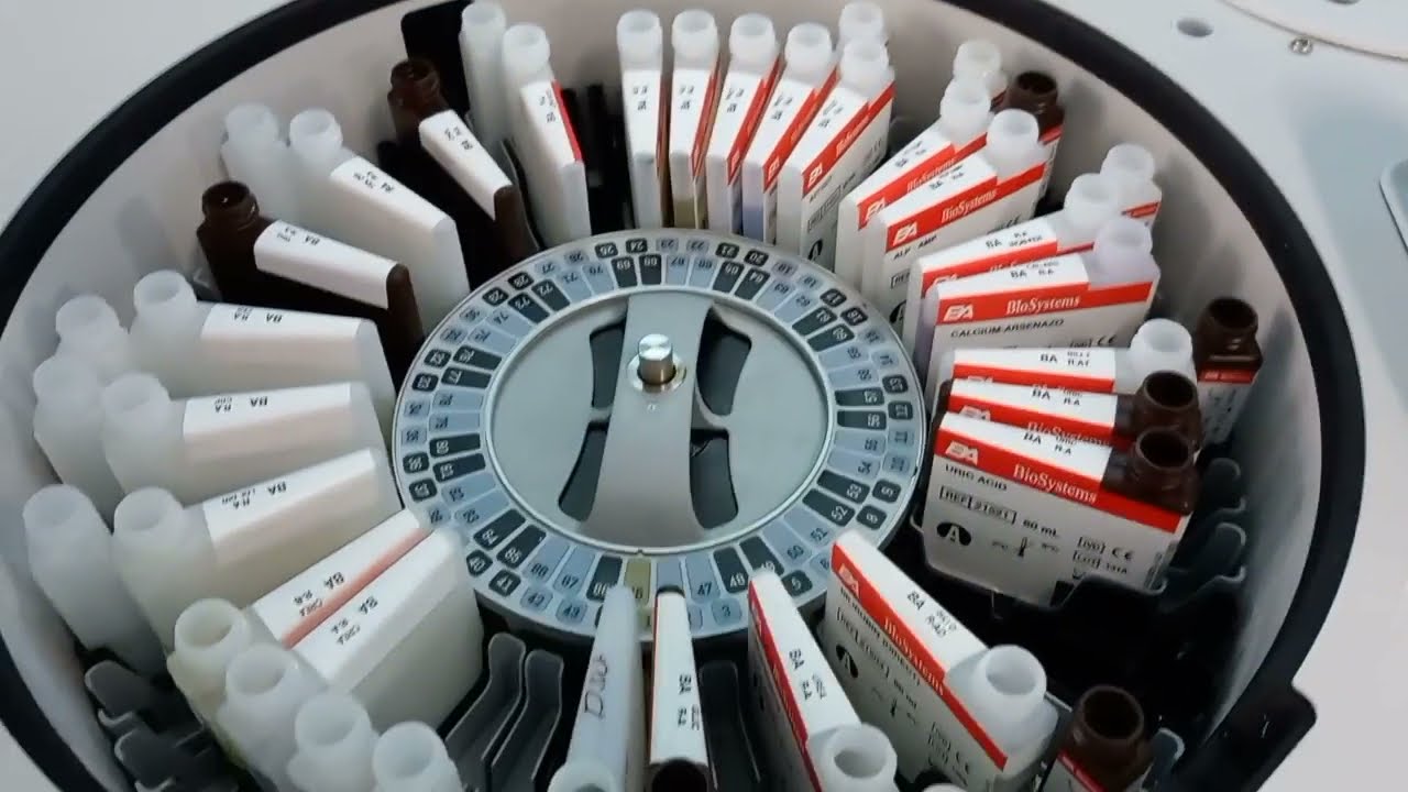 How to Run Biochemistry Test in Fully Automatic Analyzer