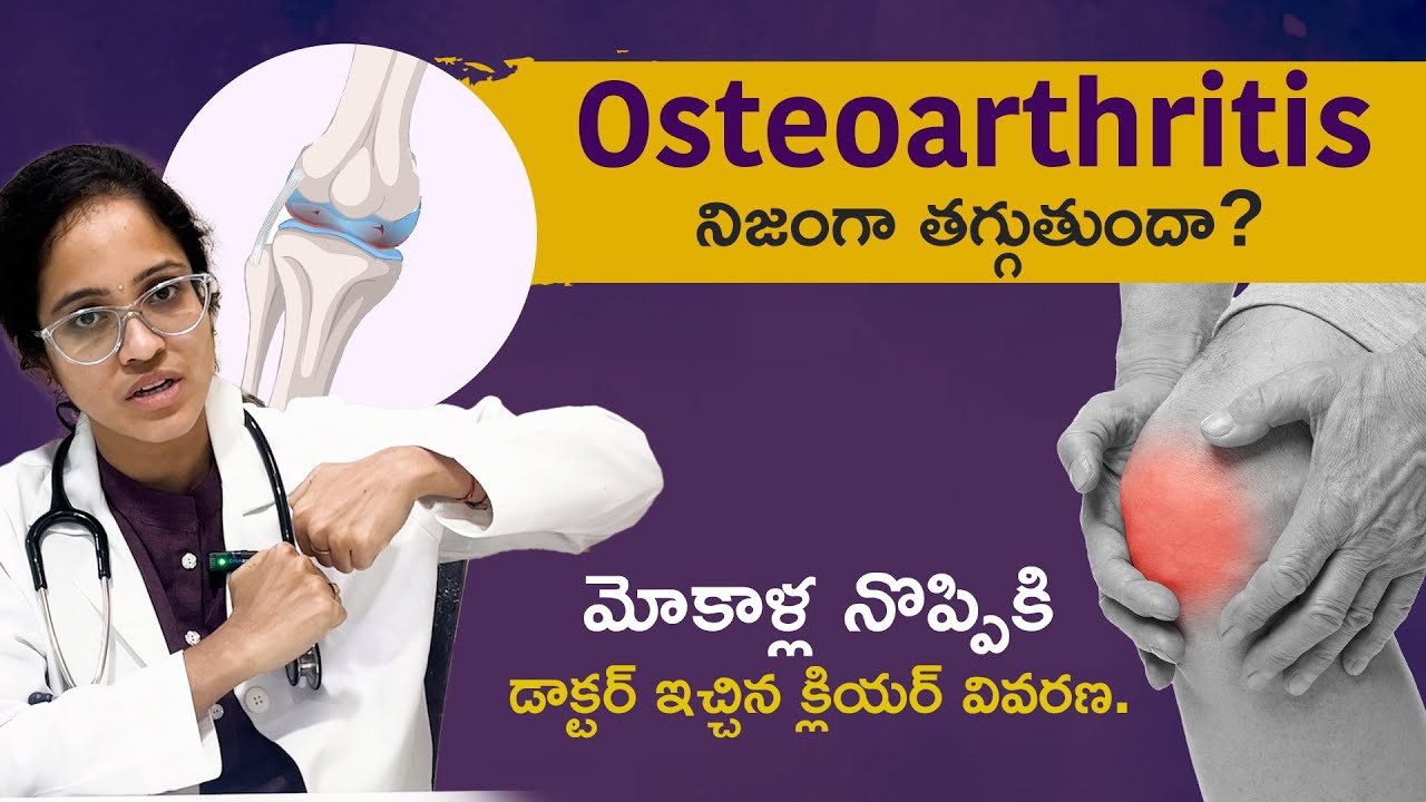 మోకాళ్ల నొప్పి శాశ్వతంగా తగ్గుతుందా? డాక్టర్ క్లియర్ ఓపెన్ టాక్! #kneepain #arthiritis #doctorvideo