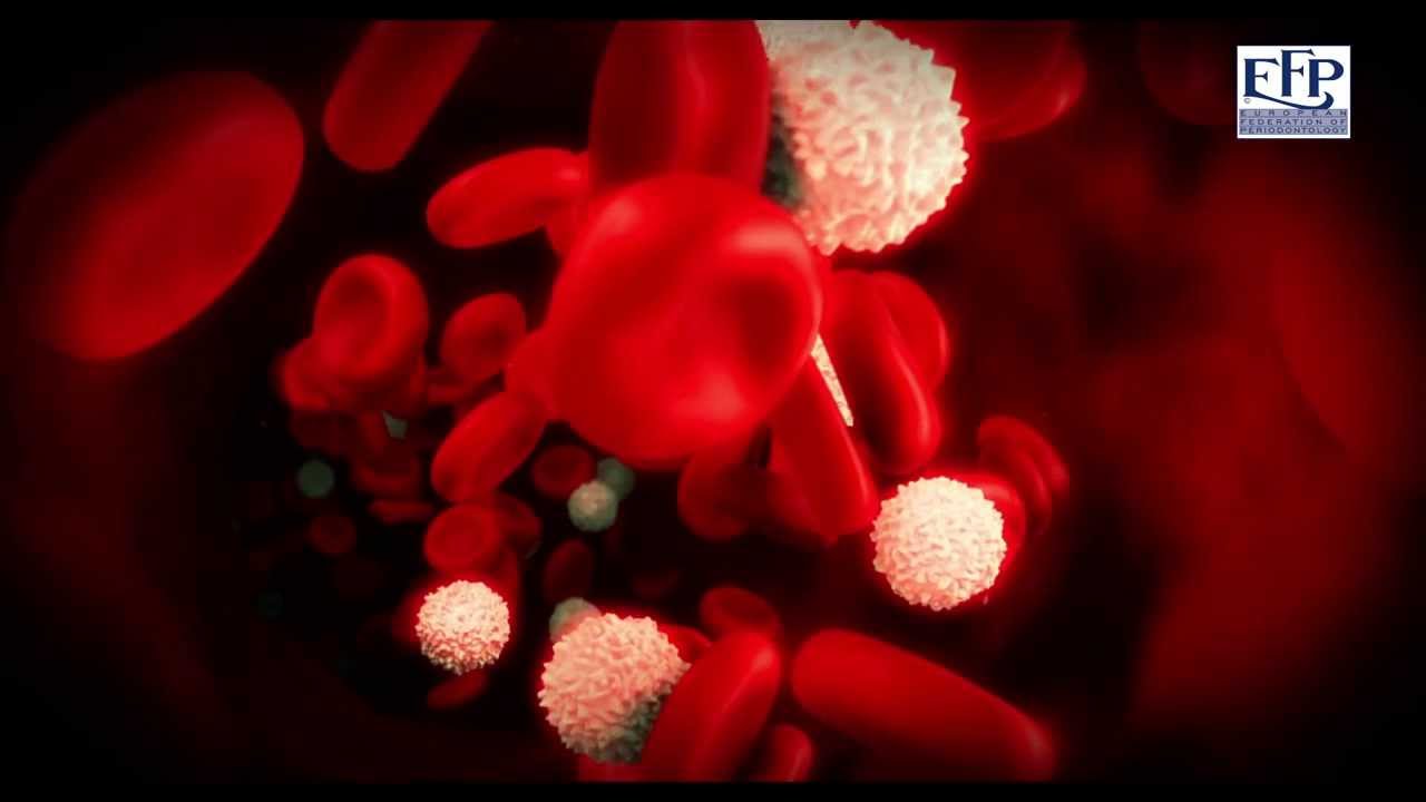 Cardio and periodontal disease