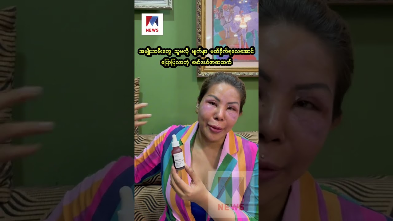 အမျိုးသမီးတွေ သူမလို မျက်နှာ မထိခိုက်ရလေအောင် ပြောပြလာတဲ့ မော်ဒယ်ဇာဇာထက်