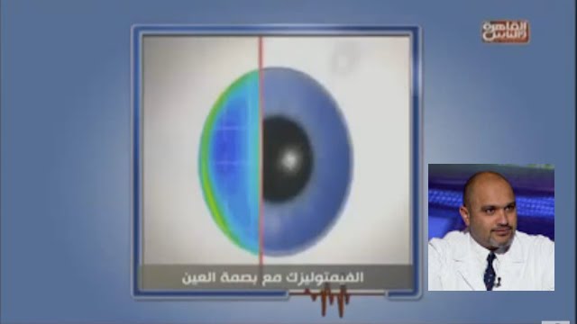 شاهد خطوات عملية الكاستم ليزك او الفيمتو ليزك مع بصمة العين | دكتور أشرف سليمان