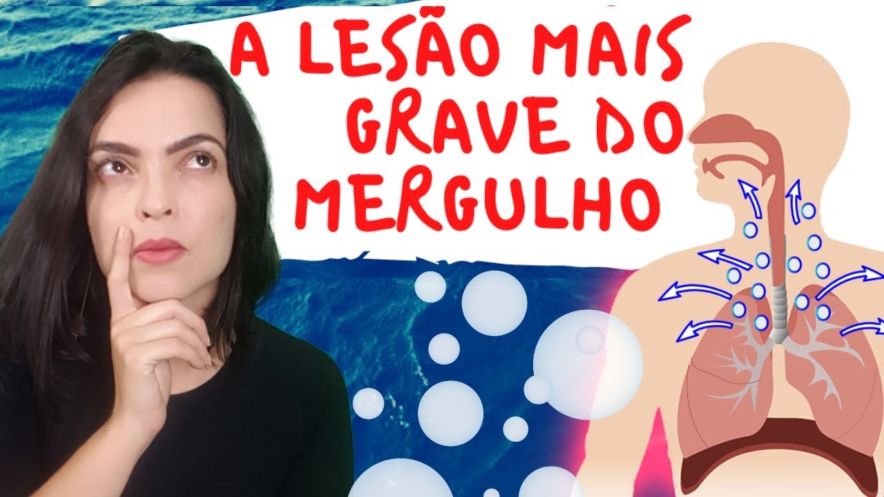 Qual a lesão mais grave que existe  no mergulho?