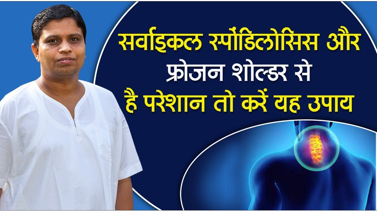 सर्वाइकल स्पोंडिलोसिस और फ्रोजन शोल्डर से है परेशान तो करें यह उपाय || Acharya Balkrishna