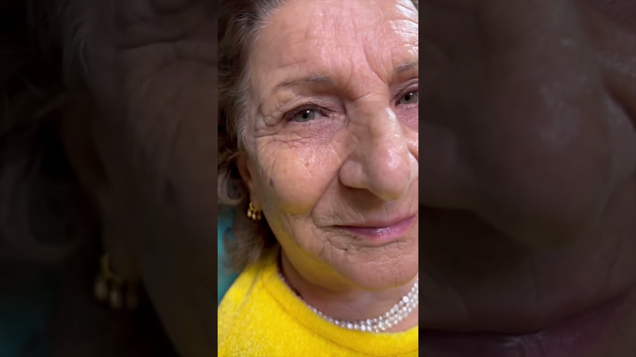 جوانسازی پوست صورت ( درمان چروک ) با یو_لیزر   Rejuvenating with you_Laser (removing wrinkles)