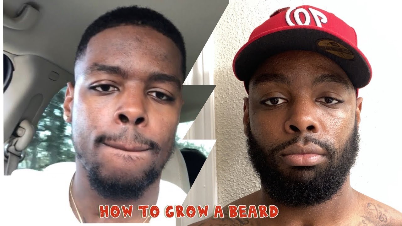 How to Grow a Beard | UPDATE *Minoxidil*