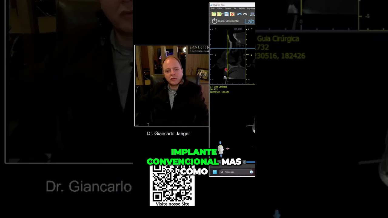 Uma t&eacute;cnica de implante dent&aacute;rio inovadora, utilizando o revolucion&aacute;rio Pilar Z. #implantedentario