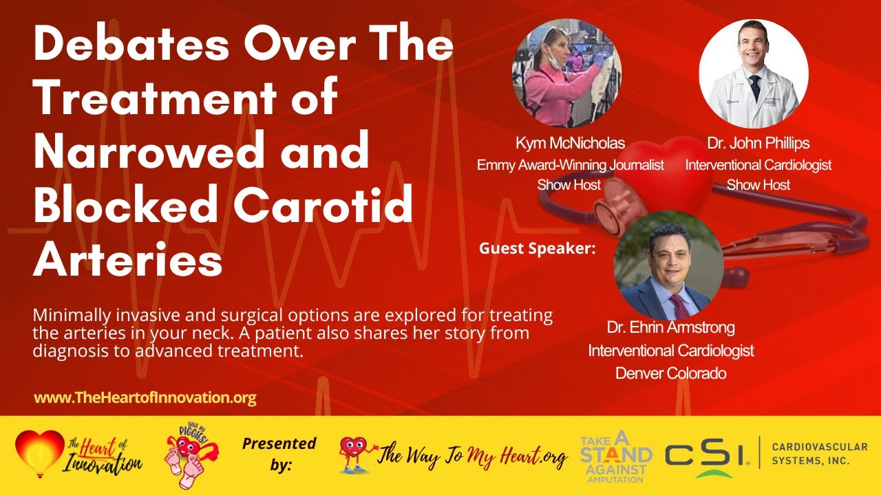 Debates Over The Treatment of Narrowed and Blocked Carotid Arteries