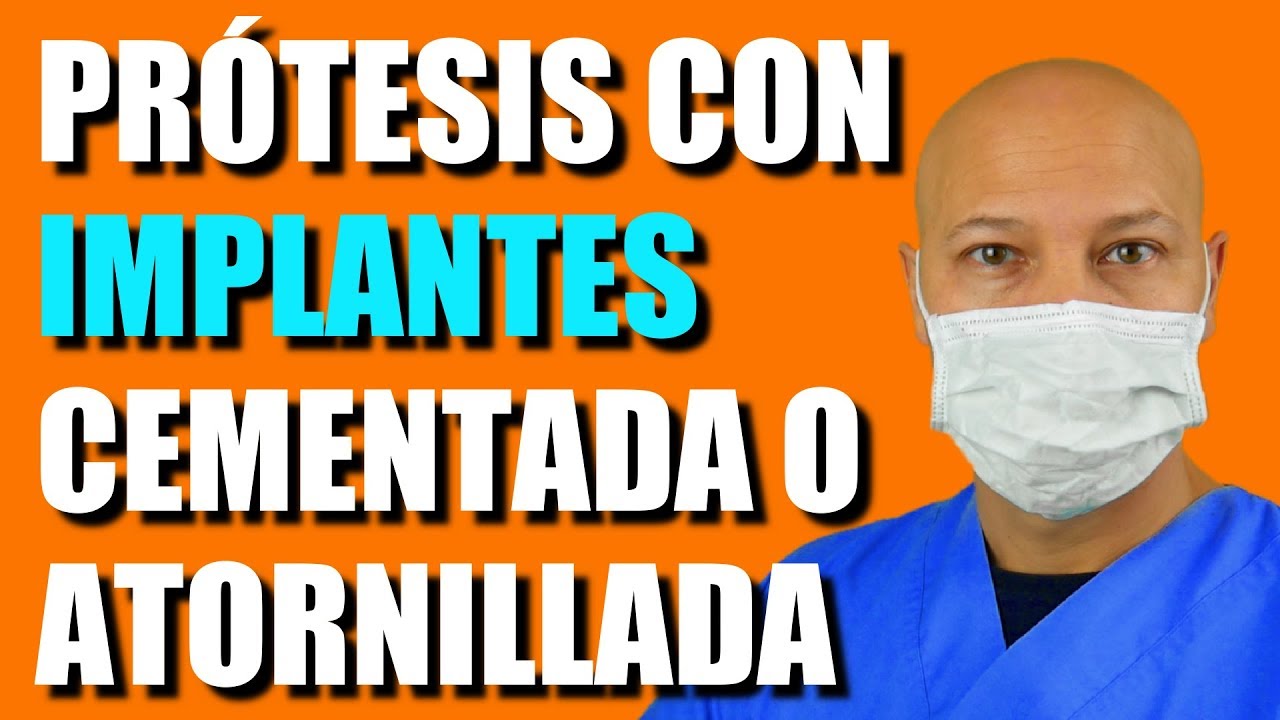 IMPLANTES con DIENTES ATORNILLADOS o CEMENTADOS, CUAL es MEJOR?