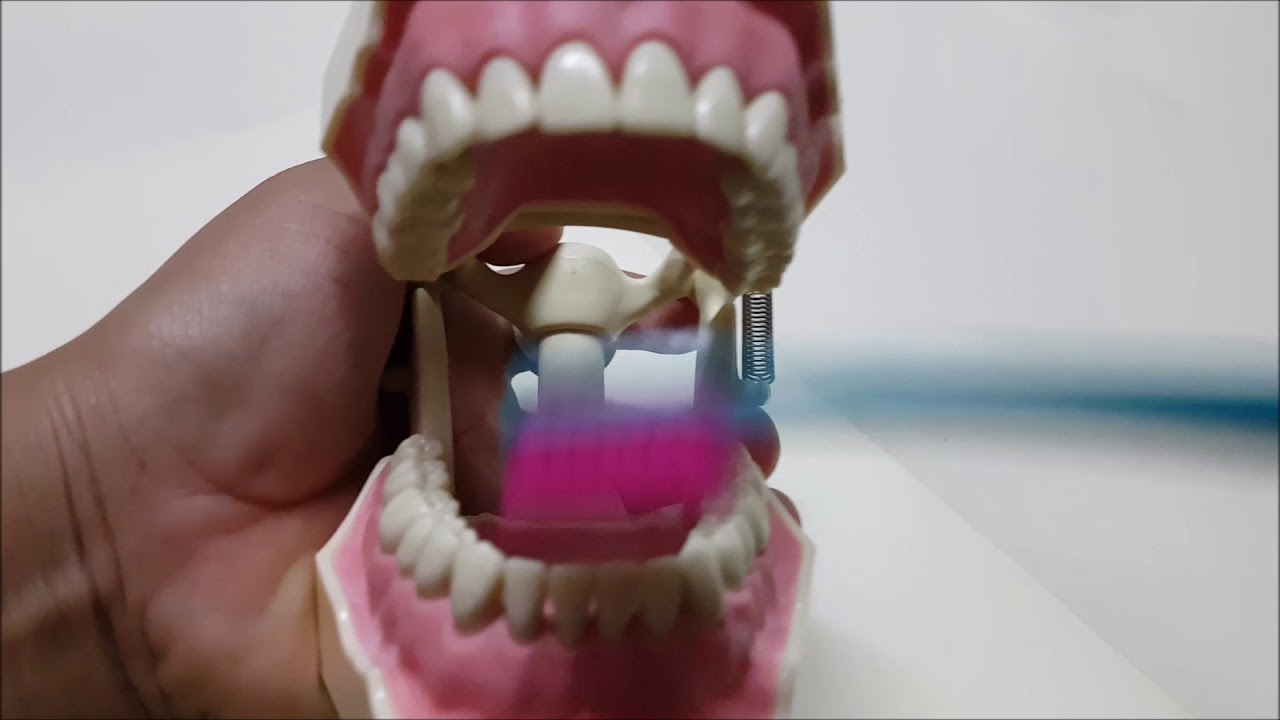 TECNICA DE CHERTERS VIDEO