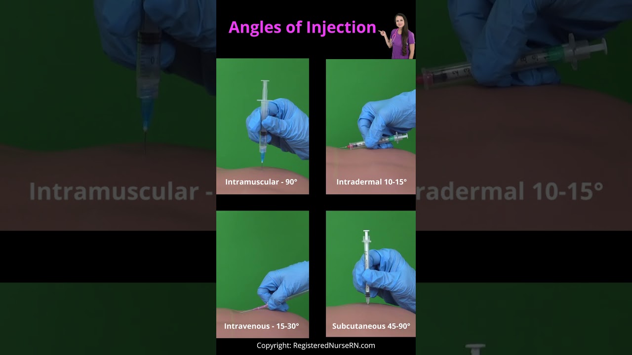 Angles of Injections Nursing: Subcutaneous, Intradermal, Intravenous (IV), Intramuscular