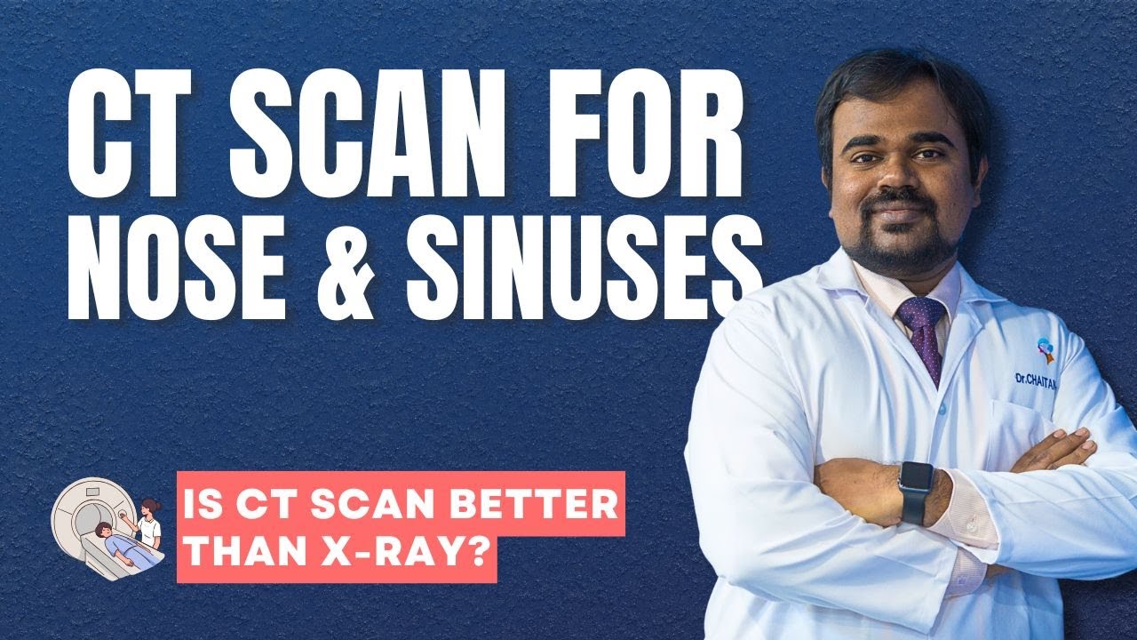 КТ носовых пазух | Синусит | Доктор Г. В. К. Чайтанья Рао