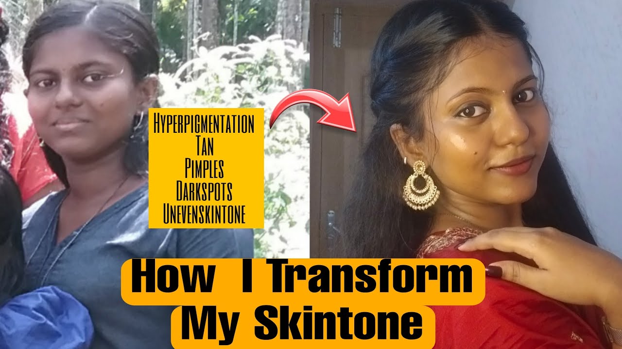 ഞാൻ എങ്ങനെയാണ് Tan മാറ്റിയത് ⁉️My skincare Journey-Part-1