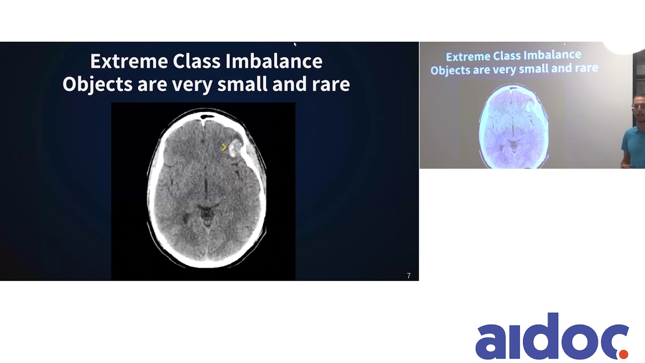 Applying the Cutting Edge of Object Detection to Medical Imaging