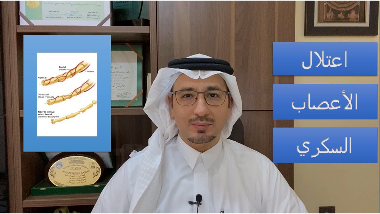اعتلال الأعصاب السكري - د. محمد قرملي